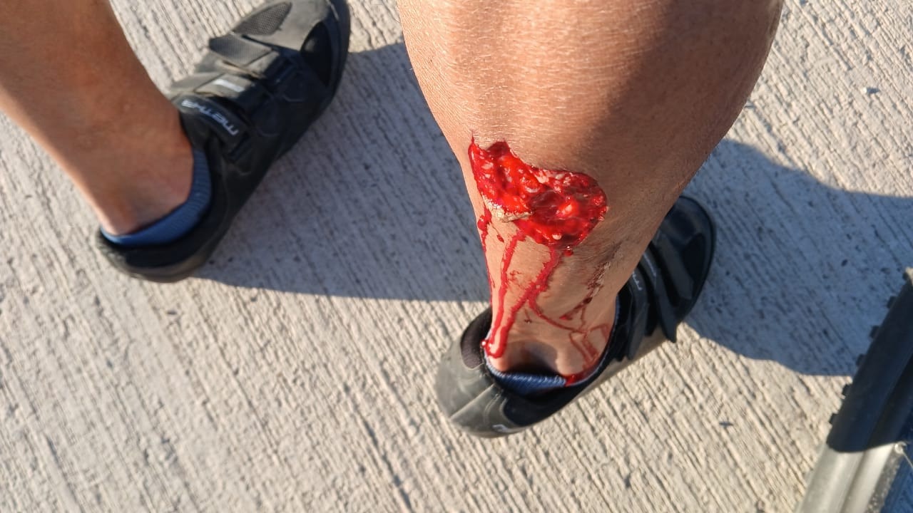 PERRO MORDIÓ A ATLETA